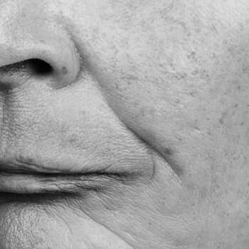 QMS Medicosmetics Fahler Teint kaufen