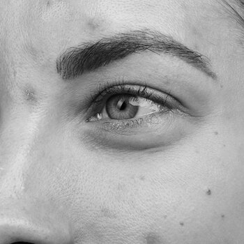 QMS Medicosmetics Junge Haut kaufen