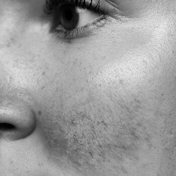 QMS Medicosmetics Sensible Haut kaufen