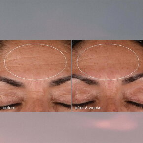 Dermalogica Age Smart Dynamic Skin Recovery SPF-50 50 ml