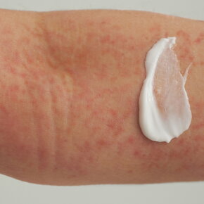 Dado Sens EXTRODERM Hautbalsam 200 ml