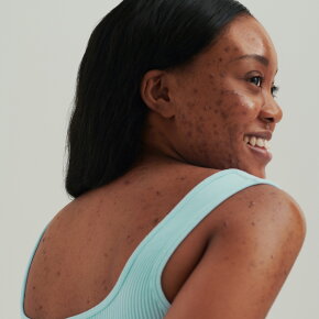 Dado Sens PURDERM Pickel-Stopp Roll-on 10 ml