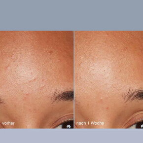 Dermalogica Daily Microfoliant 13 g