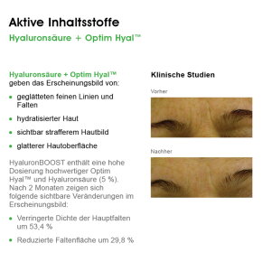 BIOMED Vergiss Dein Alter Kopf Hoch Chin Up Creme 40 ml