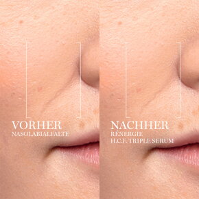 Lancôme Rénergie H.C.F. Triple Serum 50 ml