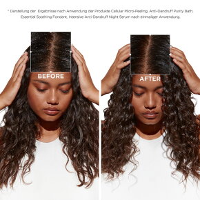 Kérastase Symbiose Sérum Cellulaire Nuit Anti-Pelliculaire Intensif 90 ml