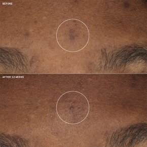 Clinique Even Better Clinical Brightening Moisturizer 50 ml