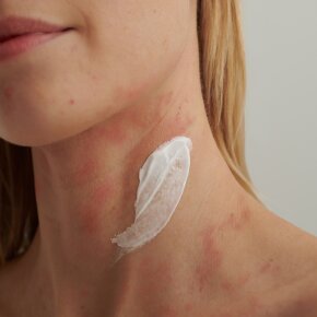 Aktion - Dado Sens EXTRODERM Intensivcreme 75 ml