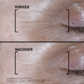 Filorga Time-Filler Shot 5XP Gesichtsserum 15 ml