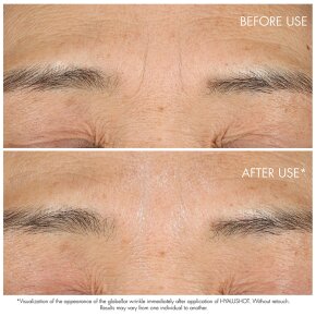 DIOR Capture Totale Hyalushot 15 ml