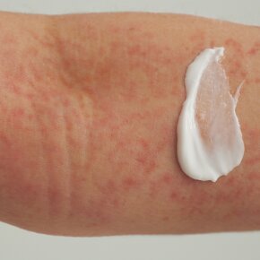 Aktion - Dado Sens EXTRODERM Hautbalsam 25 ml