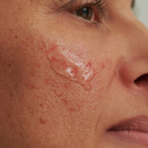 Aktion - Dado Sens SENSACEA Gesichtsemulsion 15 ml