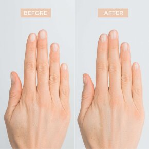 Artdeco Natural Nail Treatment 10 ml