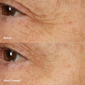 Clinique Smart Clinical Repair Overnight Cream & Mask 50 ml