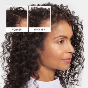 Nioxin Anti-Hair loss Shampoo 240 ml