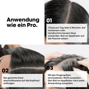 L'Oréal Professionnel Serie Expert Aminexil Advanced Anti-Haarausfall-Kur 10x 6 ml