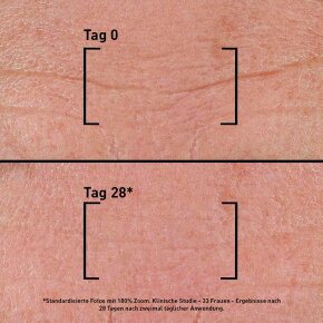 Filorga Time-Filler Intensiv Serum 5XP 30 ml