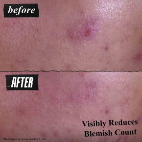 Kiehl's Gently-Effective Blemish Treating Cleansing Paste 125 ml