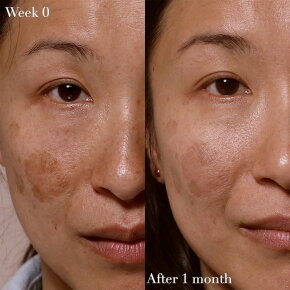 Omorovicza Elixir 30 ml