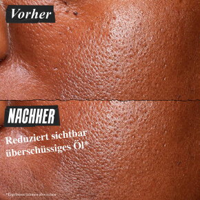 Kiehl's Ultra Pure High-Potency Serum 30 ml 5% Niacinamide