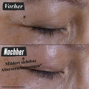 Kiehl's Super Multi-Corrective Eye Zone Treatment 14 ml