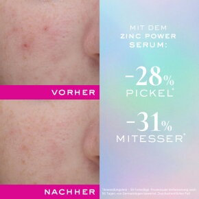 Nuxe Zinc Power Serum 30 ml