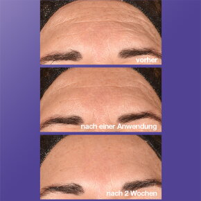 Dermalogica Phyto Nature E2 Exosom Treatment 100 ml