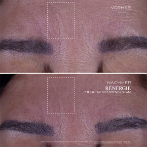 Lanc&ocirc;me R&eacute;nergie Collagen Lift-Extend Cream 50 ml