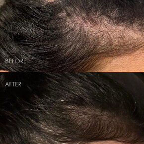 SWEED The Hair Serum 6 ml