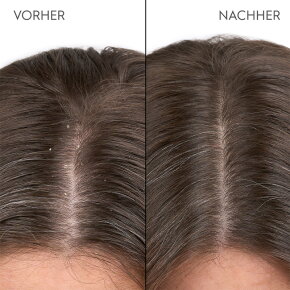 Kerasilk Anti-Schuppen Shampoo 250 ml