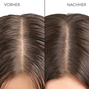 Kerasilk Kopfhaut & Haar Peeling 200 ml