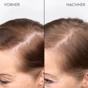 Kerasilk Verdichtendes Kopfhaut Serum 100 ml