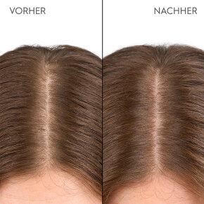 Kerasilk Feuchtigkeitsspendende Kopfhaut Drops 100 ml