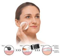 Biotulin SkinRoller Microneedling Faltenkorrektur